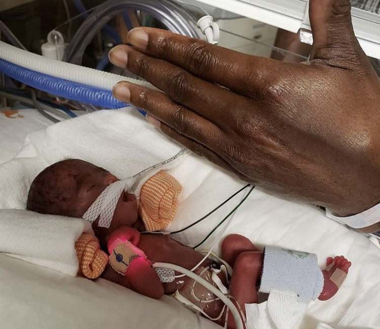 Miracle baby weighing less than 1 pound at birth goes home healthy